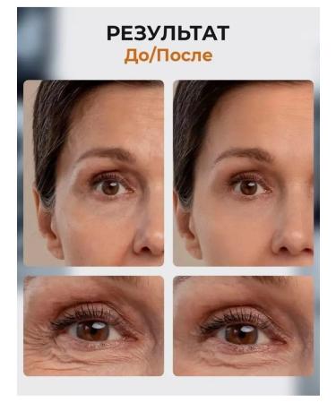 Million Pauline Face cream moisturizing the anti-aging SYN-AKE New !! - Buy Online on GoSupps.com