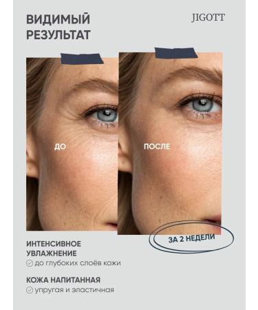 Jigott Face cream anti -aging bleaching - Buy Online on GoSupps.com