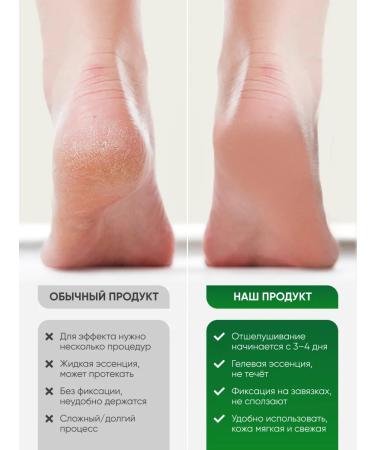 Jigott Piling Pedicier toes for legs mask - Buy Online on GoSupps.com