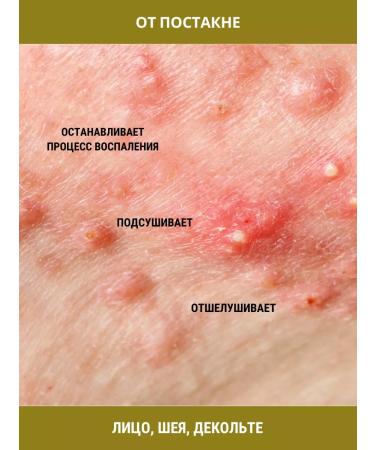 Tough Guy Facial mask of Badyaga 6pcs 30g - Buy Online on GoSupps.com