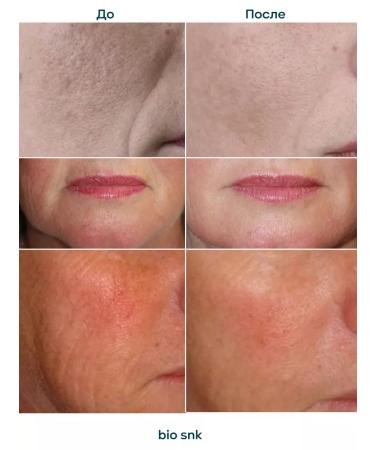 BIO SNK Cream-Box for Facial Facial with SPF 15 Peptide Syn-AKE - Buy Online on GoSupps.com