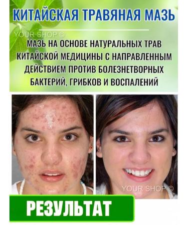 Miracle ointment from psoriasis Zudaifa 10 pcs - Buy Online on GoSupps.com