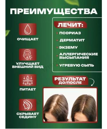 Nisa Hair shampoo soap 5pcs - Buy Online on GoSupps.com