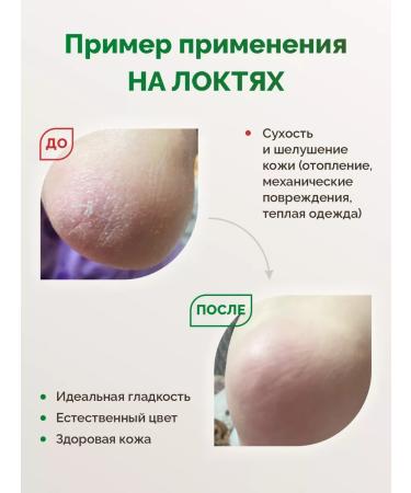 Balzam Pro Cream balm from cracks - Buy Online on GoSupps.com