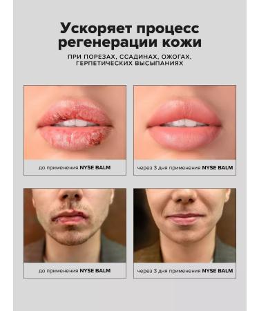 NYSE BEAUTY Healing regenerating skin balm - Buy Online on GoSupps.com