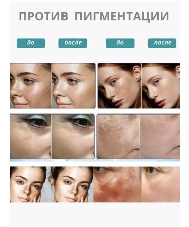 Eccos Facial anti -aging cream with snail mucin - Buy Online on GoSupps.com