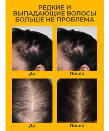 JoceJoli Hair growth shampoo - Buy Online on GoSupps.com