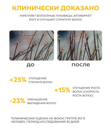 JoceJoli Hair growth shampoo - Buy Online on GoSupps.com