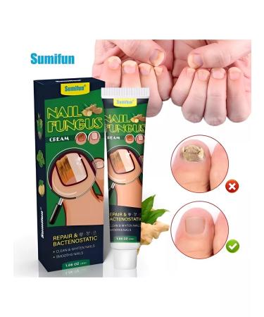 LAMIIA KING Nail fungus agent 30 g - Buy Online on GoSupps.com