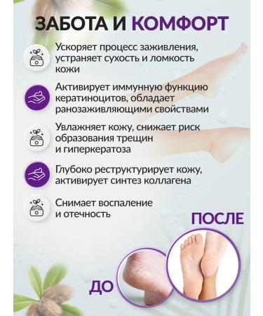 SAGITTA Cream - balm for diabetic foot - Buy Online on GoSupps.com