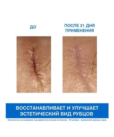 URIAGE Uryazh cycs cream barederm 100 ml - Buy Online on GoSupps.com