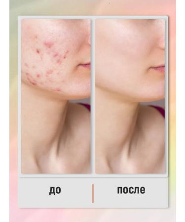 PAW FACTORY Mask for problem skin care - Buy Online on GoSupps.com