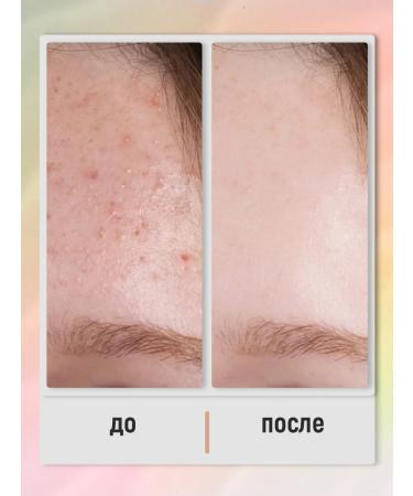 PAW FACTORY Mask for problem skin care - Buy Online on GoSupps.com