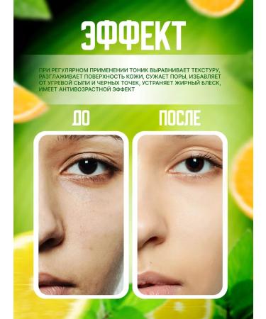 Elizavecca Korean facial toner - Buy Online on GoSupps.com