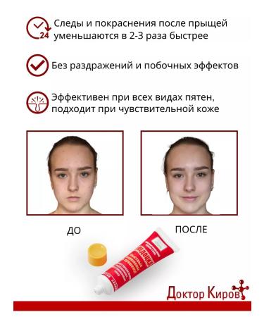 Dr Kirov / Dr Kirov Cosmetic Cream from post -acne on the face traces of acne "Traceocide" - Buy Online on GoSupps.com