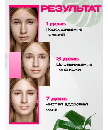 PimpleFree Acne cream for teenagers - Buy Online on GoSupps.com