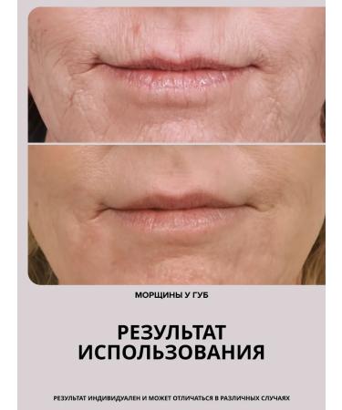 Drs Mesoroller 0.5 mm for face and hair growth and beard - Buy Online on GoSupps.com