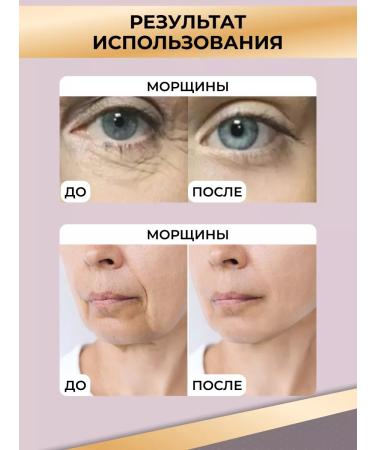 ZGTS Mesoroller for the face 0.3 mm against wrinkles around the eyes - Buy Online on GoSupps.com
