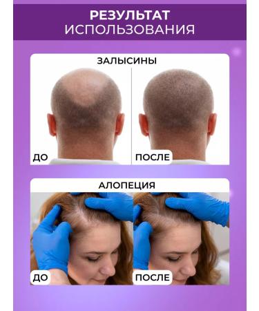 Drs Mesoroller for body and hair growth and beard set 3 in 1 - Buy Online on GoSupps.com