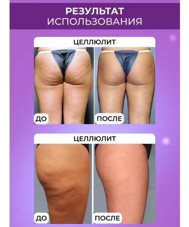 Drs Mesoroller for body and hair growth and beard set 3 in 1 - Buy Online on GoSupps.com