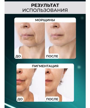 DRS Mesoroller of hair and beard growth face roller 0.5 mm - Buy Online on GoSupps.com