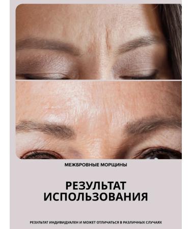 DRS Mesoroller for face against wrinkles and pigmentation 0.3mm - Buy Online on GoSupps.com