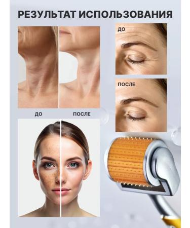 ZGTS Mesoroller for growth and from hair loss 0.5 mm for the face - Buy Online on GoSupps.com