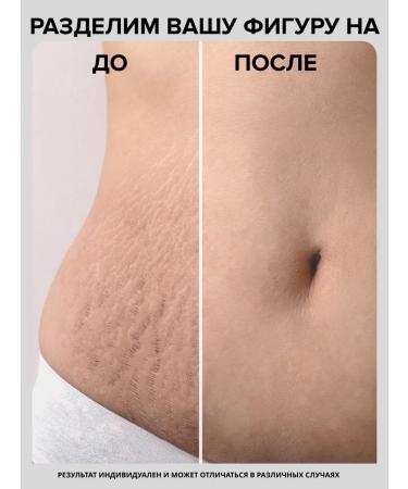 DRS Mesoroller for body and hair growth 1.5 mm - Buy Online on GoSupps.com