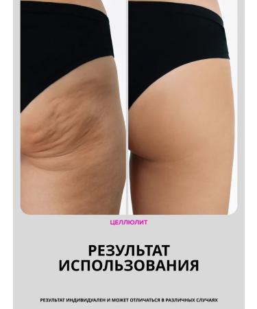 DRS Mesoroller for body and hair growth 1.5 mm - Buy Online on GoSupps.com