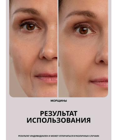 Drs Mesoroller for the face and growth of hair and eyebrows 0.75 mm - Buy Online on GoSupps.com