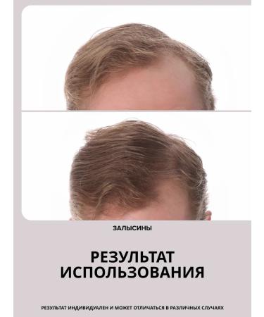 Drs Mesoroller for hair growth and beard 1.5mm - Buy Online on GoSupps.com