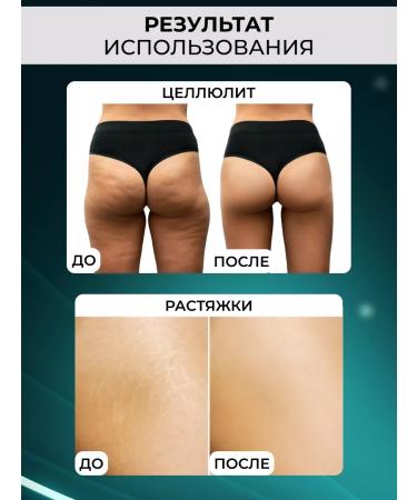 DRS Mesoroller from scars and scars cellulite 2.0 mm - Buy Online on GoSupps.com