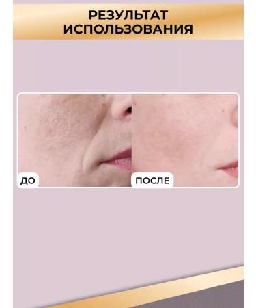 ZGTS Mesoroller for the face and growth of hair and beard 1.5 mm - Buy Online on GoSupps.com