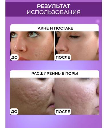 DRS Mesoroller for the face and beard 3B1 - Buy Online on GoSupps.com