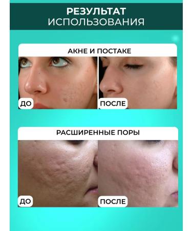 Drs Mesoroller for the face and growth of hair and beard 4V1 - Buy Online on GoSupps.com