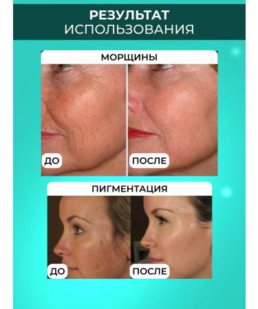 Drs Mesoroller for the face and growth of hair and beard 4V1 - Buy Online on GoSupps.com