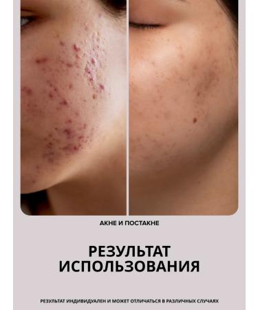 Drs Mesoroller for the face and growth of hair and beard 0.75mm - Buy Online on GoSupps.com