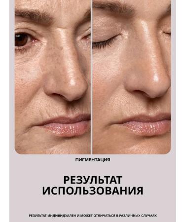 Drs Mesoroller for the face and growth of hair and beard 0.75mm - Buy Online on GoSupps.com