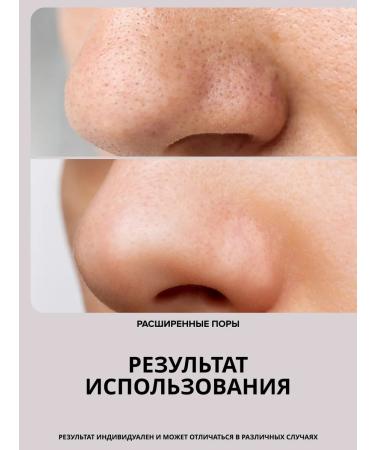 Drs Mesoroller for the face and growth of hair and beard 0.75mm - Buy Online on GoSupps.com