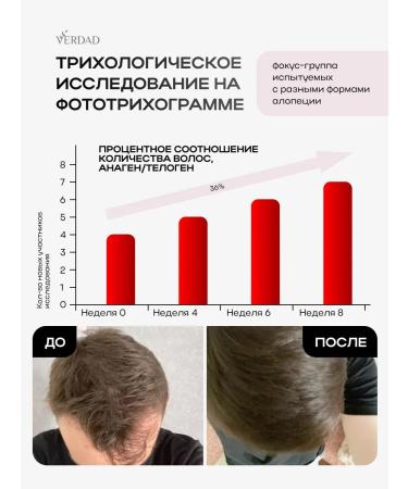 Verdad Serum from hair loss indelible - Buy Online on GoSupps.com