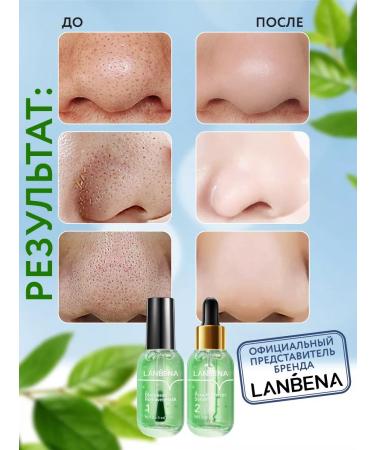 LANBENA Mask from black dots and serum for narrowing pores - Buy Online on GoSupps.com