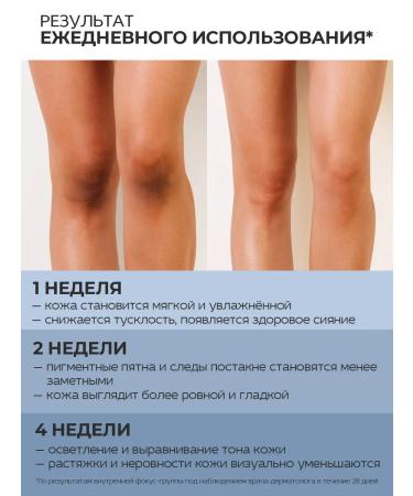 SelfLoveMedical Whitening body cream from stretch marks with retinol - Buy Online on GoSupps.com