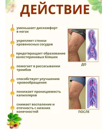 SIBERIA-SHOP Ointment from varicose veins on the legs of Altai - Buy Online on GoSupps.com