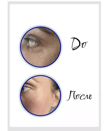 ALL FOR HEALTH Microiginal patches under the eye from wrinkle swelling collag 3 pcs - Buy Online on GoSupps.com