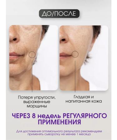 LAMELIN Face cream from wrinkles with retinol anti -aging Korea - Buy Online on GoSupps.com