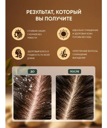 OLD GINGER KING Shampoo and air conditioning for hair growth - Buy Online on GoSupps.com