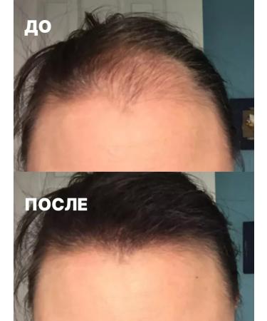 Fazax Hair serum growth and recovery 4 pcs - Buy Online on GoSupps.com