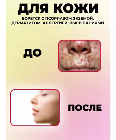 bee lab Monarchy extract from acne for nails - Buy Online on GoSupps.com