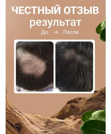 Mandragora Magic Beauty A set of natural hair products with uglia - Buy Online on GoSupps.com