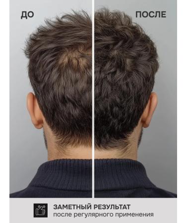 LunaLine Male shampoo from hair loss - Buy Online on GoSupps.com